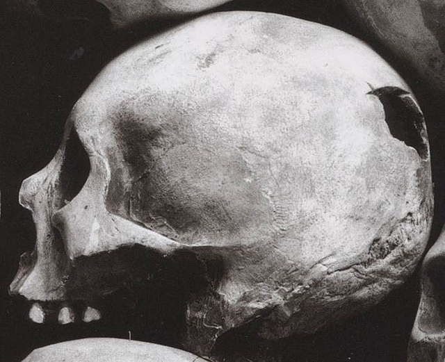 Trepanning